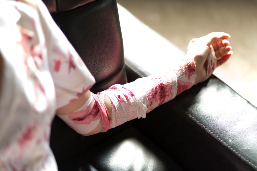 兔玩映画系列 87写真-护士姐姐