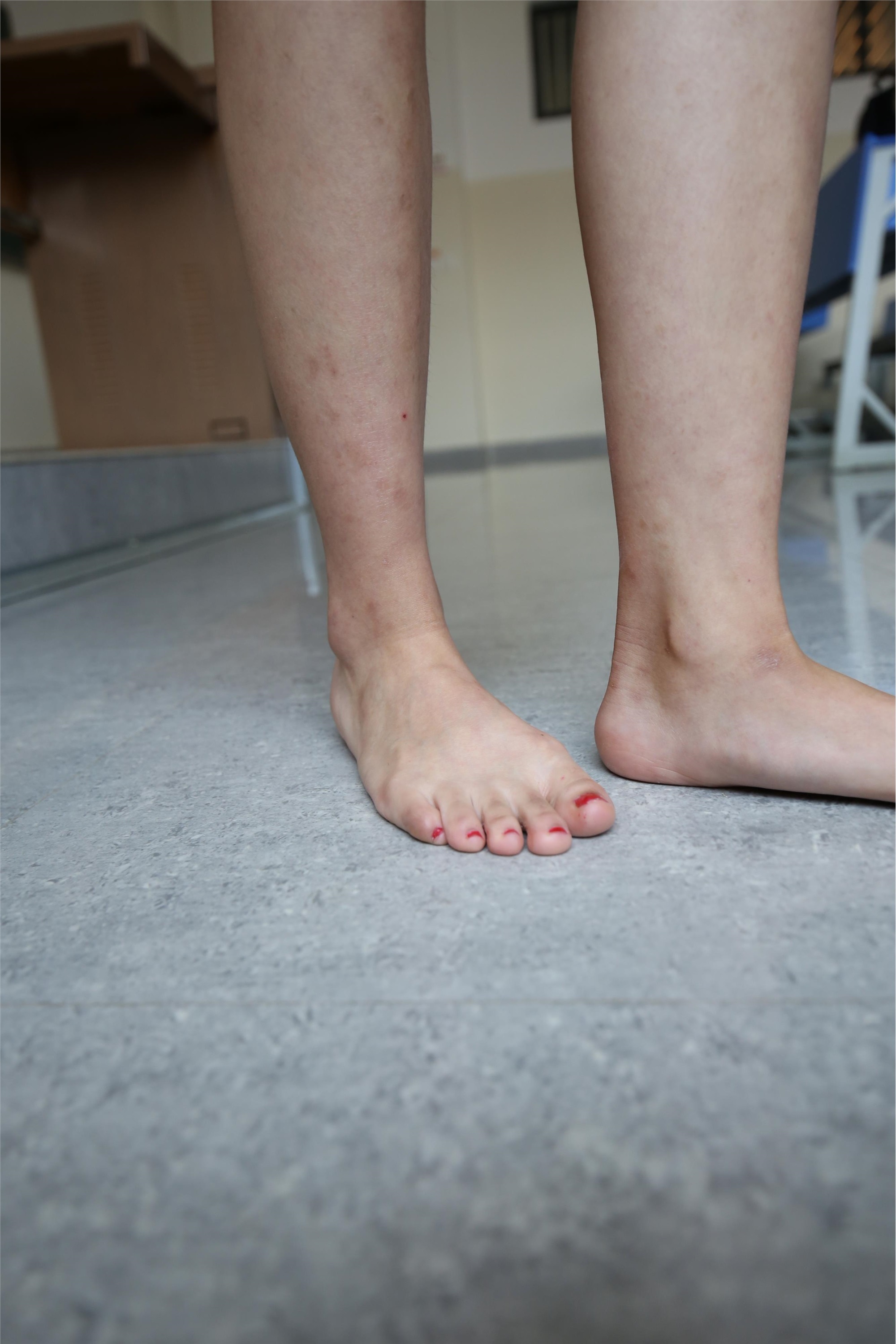 大西瓜套图 S024 裸足长丝 315p 1sp1